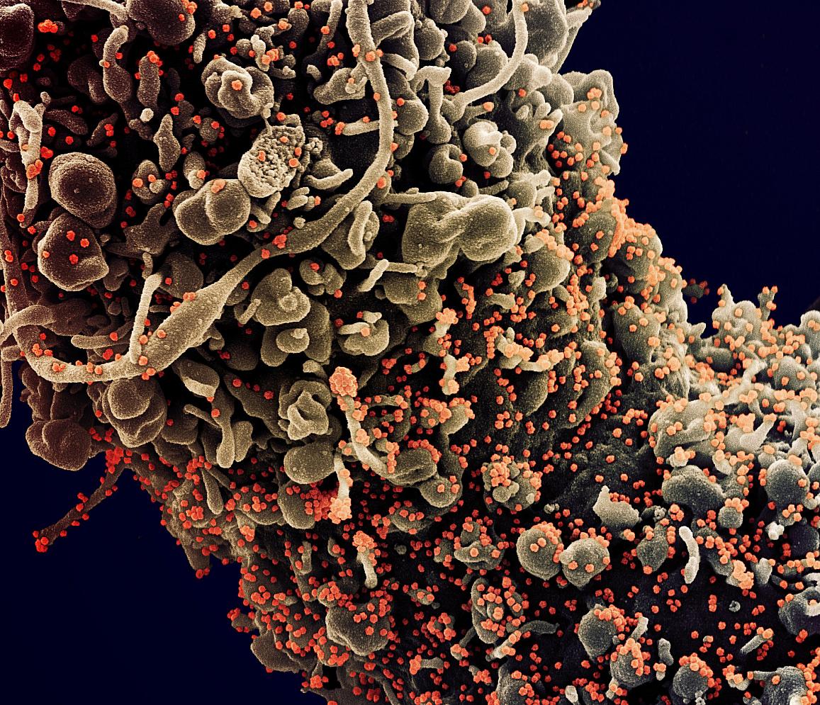 Micrograph of an infected cell