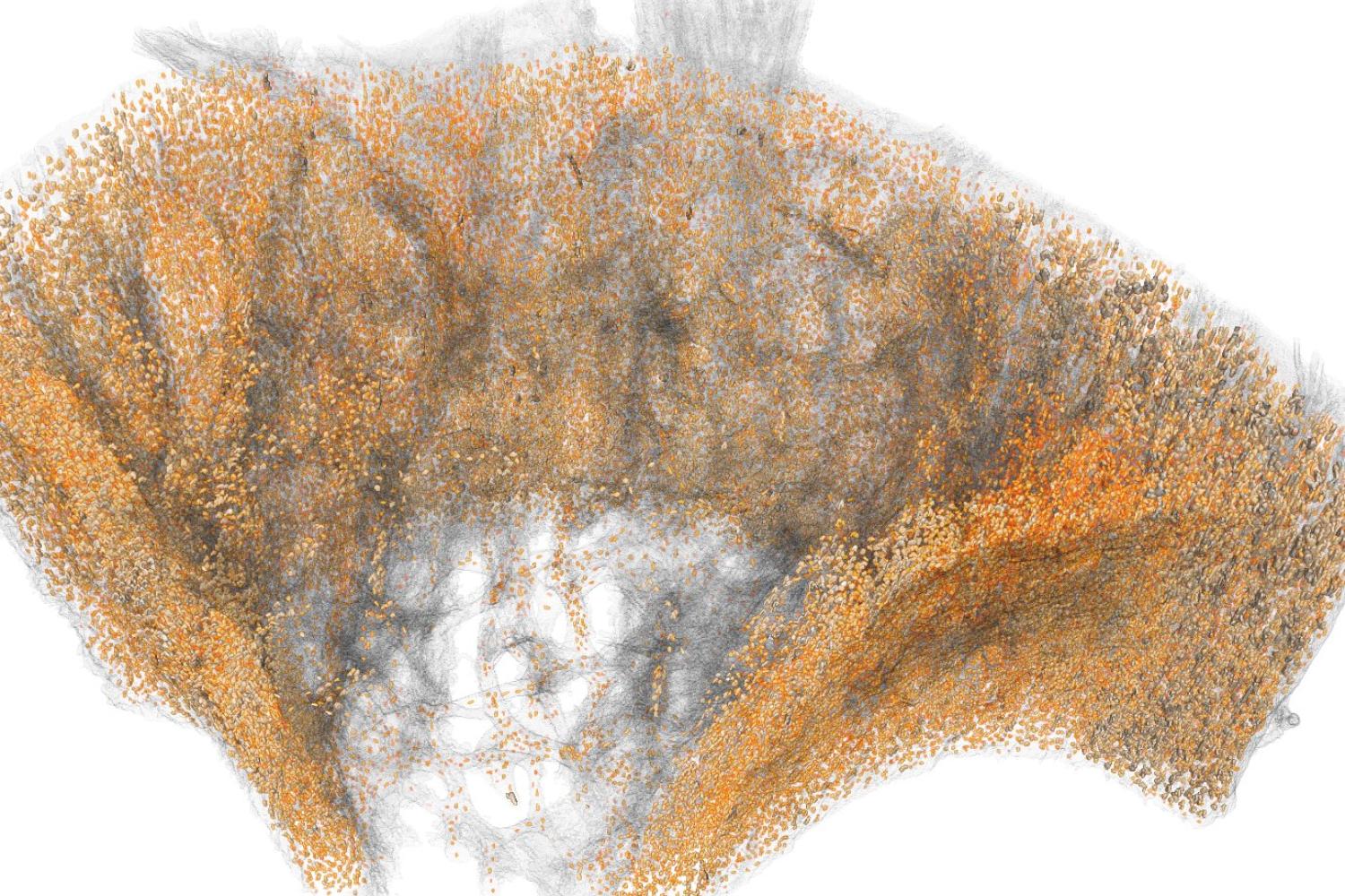 axe-shaped microscopic image.