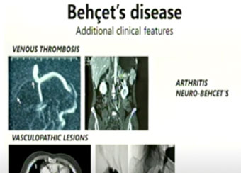 Powerpoint slide showing microscope imagery.