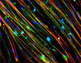 Colorful microscopic image showing restoration of dystrophin in Duchenne muscular dystrophy 