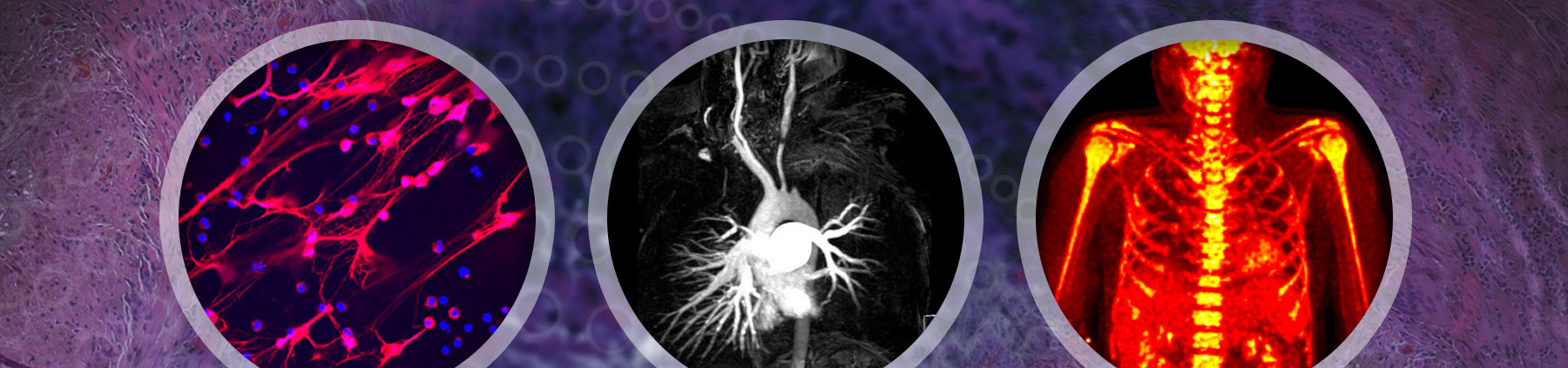 Montage of a microscopic image, an illustration of inflamed organs and a visual of a rib cage.