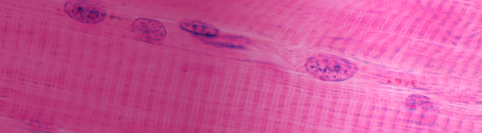 striated skeletal muscle fiber