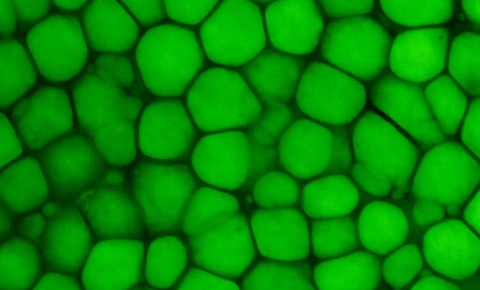 This image shows a confocal scan of mouse ear lipocartilage stained with a green fluorescent lipid dye called BODIPY. Large lipid vacuoles are bright green.