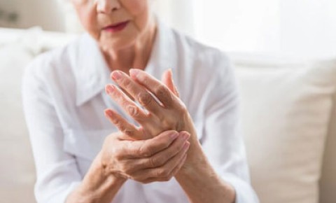 An old lady with rheumatoid arthritis