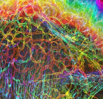 image showing the interface of skin and muscle during mammalian development