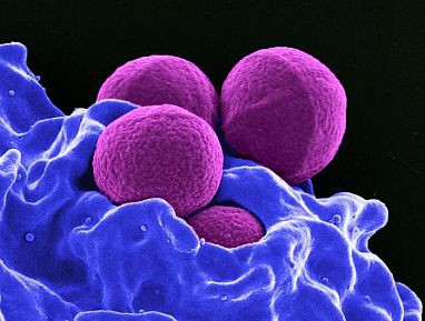 Image of MRSA bacteria being engulfed by neutrophils