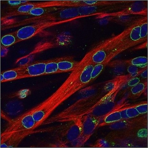 Microtubules (red) are long protein filaments which have been implicated in Duchenne muscular dystrophy. Microtubules grow from protein complexes that contain the protein pericentrin (green). Credit: Evelyn Ralston, Ph.D., NIAMS Light Imaging Section.