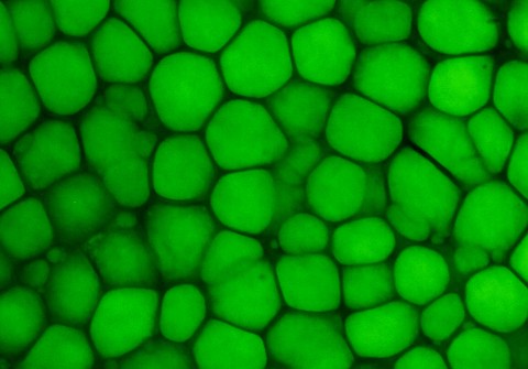 This image shows a confocal scan of mouse ear lipocartilage stained with a green fluorescent lipid dye called BODIPY. Large lipid vacuoles are bright green.
