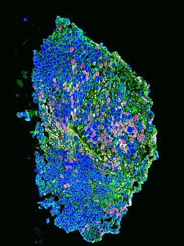 Immunofluorescence image of muscle fibers
