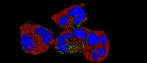 Picture of neutrophils