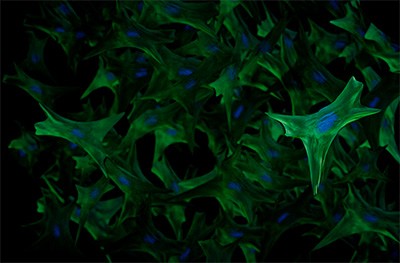 Picture of fibroblst cells stained green and blue