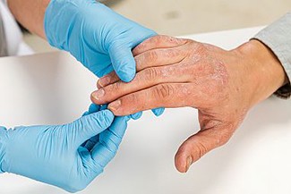 doctor wearing gloves examines hand of a patient