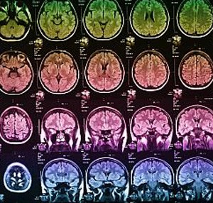 Photo showing multiple x-rays of the human brain