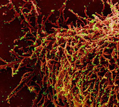 micrograph of a cell (red) infected with a variant strain of SARS-CoV-2 virus particles (green)