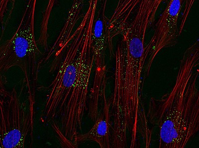 Fibroblasts (red lines with blue nuclei)