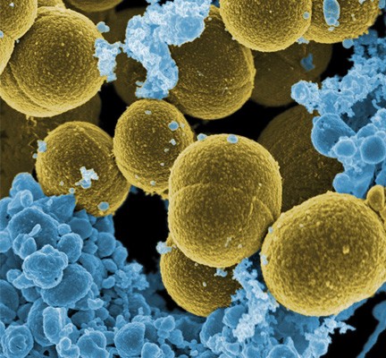 Scanning electron micrograph of S. aureus bacteria escaping destruction by human white blood cells.