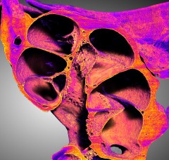 Image of a mouse cochlea, showing a section view of radial chambers in a spiral pattern
