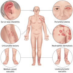 Illustration of a male human body, highlighting locations various rashes