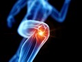 Knee graphic