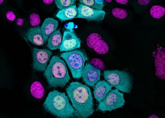 Immunofluoresecence of SAOS cells