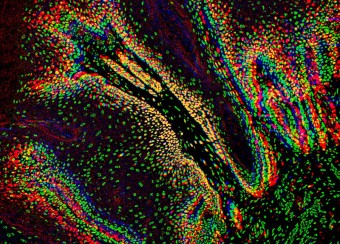 Immunofluorescence of mouse papilloma section 
