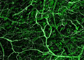 Whole-mount, fluorescence immunohistochemistry of mouse back skin