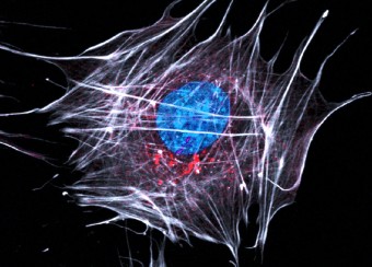 Immunocytochemistry of ameloblast-like cells