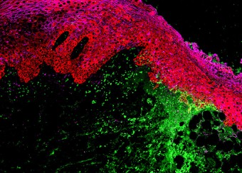 Immunohistochemistry of Oral Buccal Mucosa