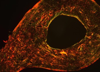 Circular shaped microscopic image.