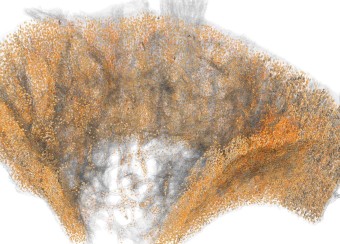 axe-shaped microscopic image.