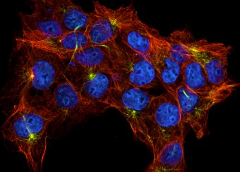 Light Imaging Section Figure 3