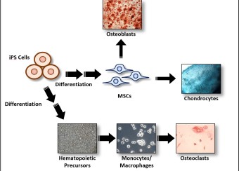 Differentiation of induced pluripotent stem cells (iPSCs) into stromal cells and hematopoietic precursors.