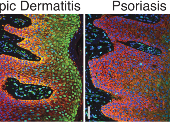 Laboratory of Skin Biology Figure 5