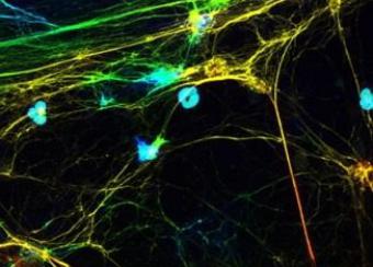 Granulocytes detected by laser confocal microscope.