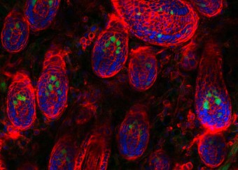 Laboratory of Skin Biology Figure 9