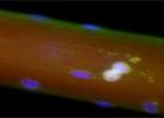 Two  skeletal muscle stem cells ( doublets in red and magenta) associated with a muscle fiber  during cell division.