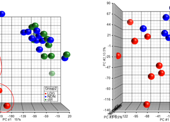 PCA: discovery of SLE patient subgrouping