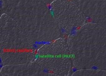The study of combining genomic and proteomic-based approaches complemented by bioinformatics and animal models. 
