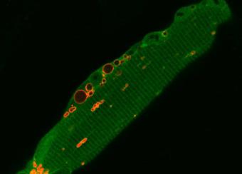 The image shows redistribution and realignment of enlarged lysosomes (red vesicles) along the plasma membrane
