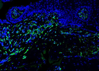 Human Buccal Mucosa Section 