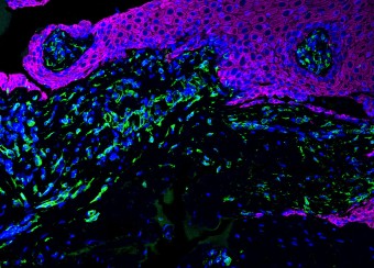Human Buccal Mucosa Section