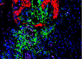 Image or oral mucosa, stained in red, green and blue.
