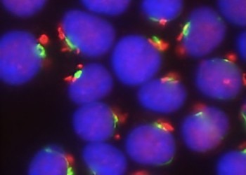 The Merkel cell carcinoma cell line, MS-1