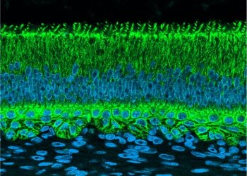  Immunofluorescence of rat enamel organ section (postnatal day 2) detecting Keratin 16 (green) and counterstained with Dapi (teal).