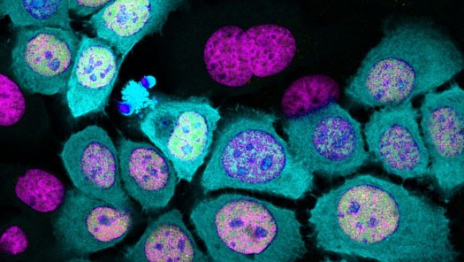 Immunofluoresecence of SAOS cells