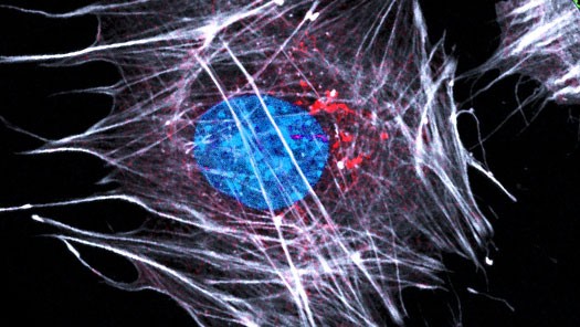 Immunocytochemistry of ameloblast-like cells