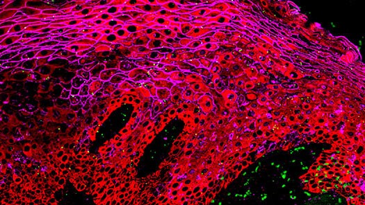 Immunohistochemistry of oral buccal mucosa