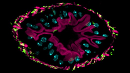 Drosophila intestine
