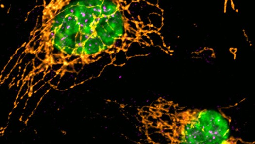 Swt1 in endothelial cells 