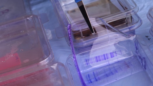 Collecting Proteins in Gel Membranes